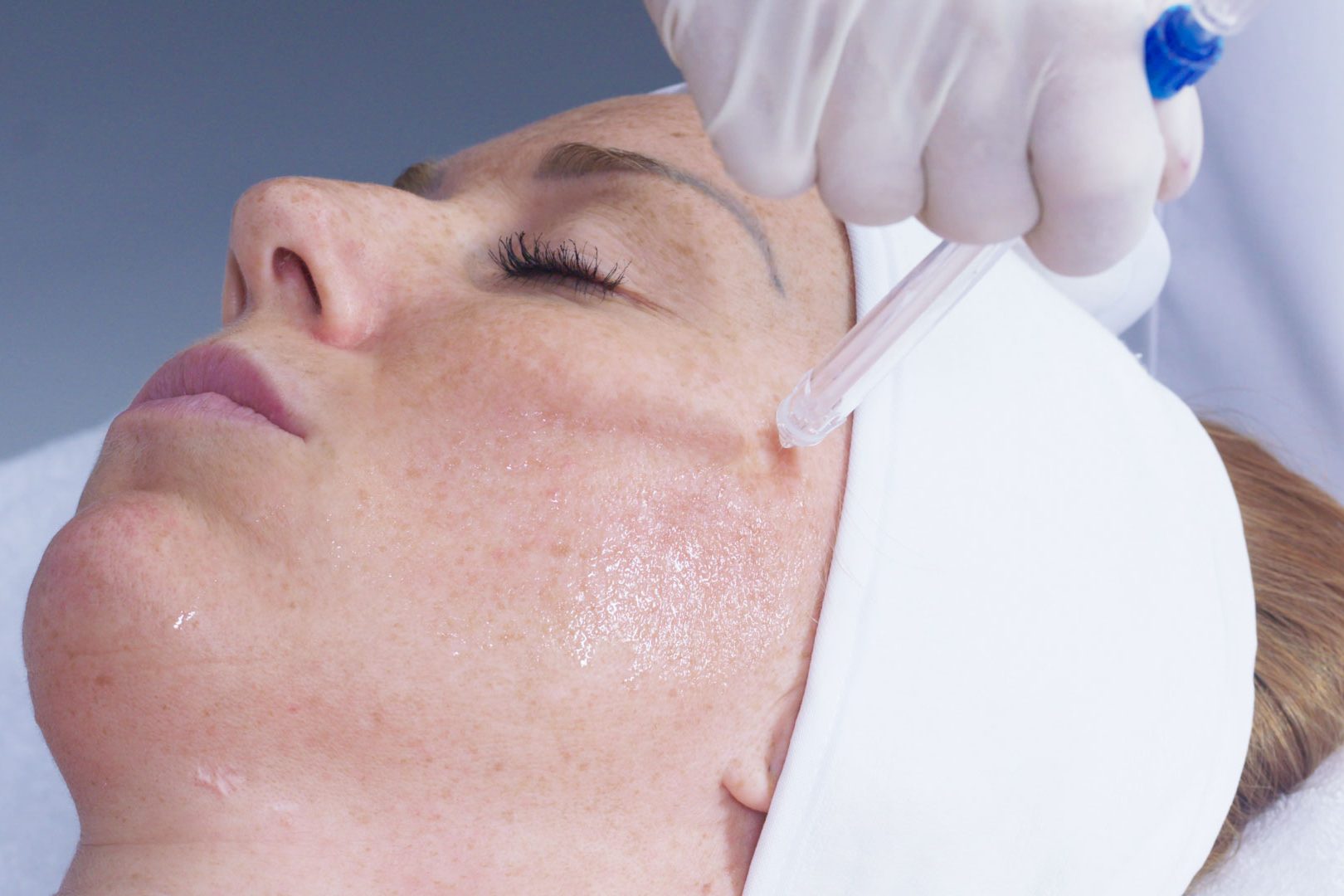 Soin Medical Jet System