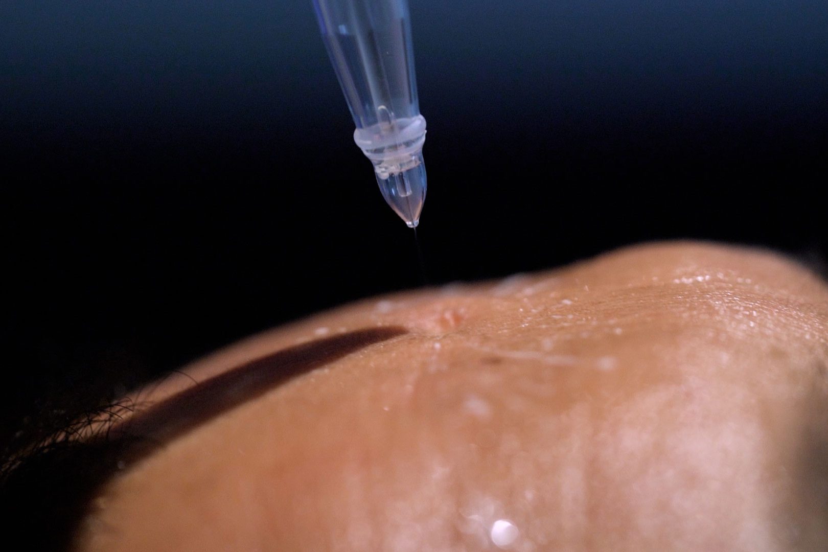 Soin Medical Jet System