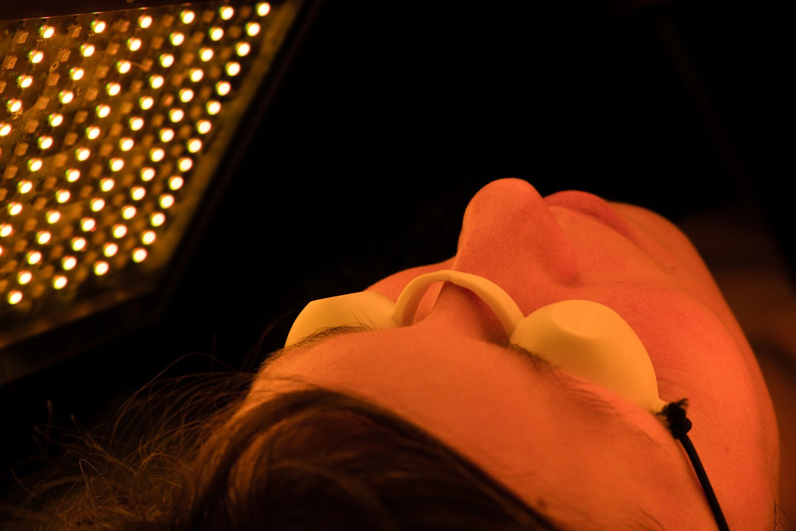 Soin LED (photobiomodulation)